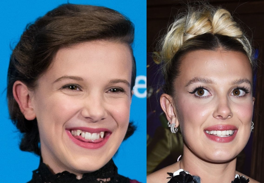 22 Child stars who proved they’re not one-hit wonders – Garlic Soda